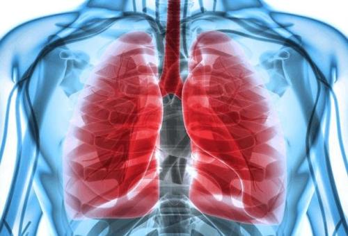 有抽电子烟得了肺癌的案例吗？
